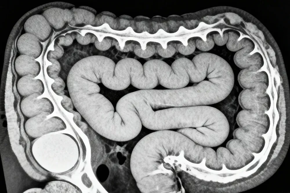 coloscanner