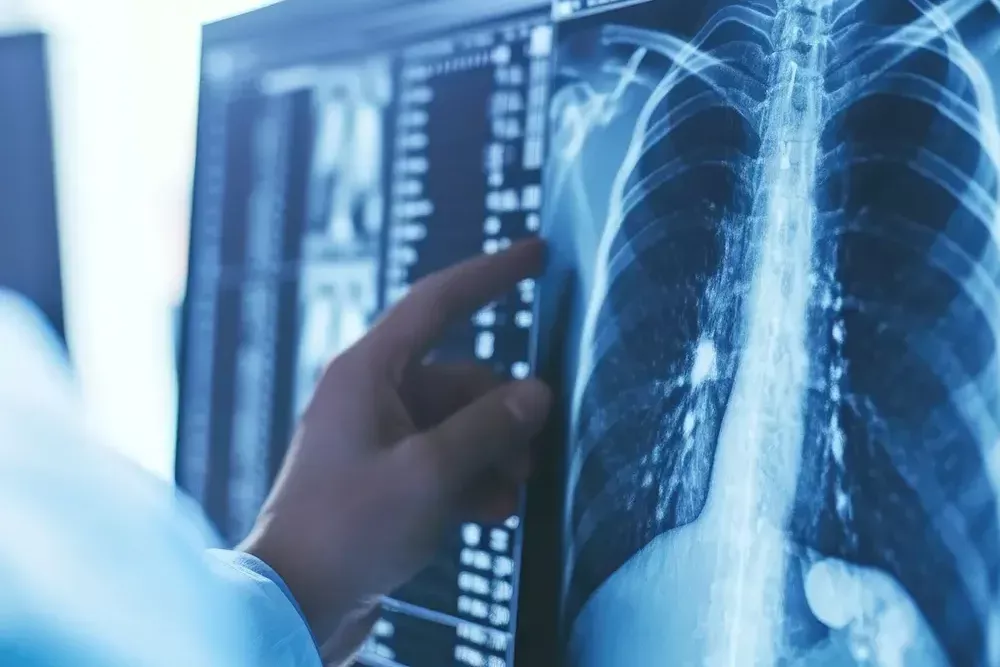 radiologie generale