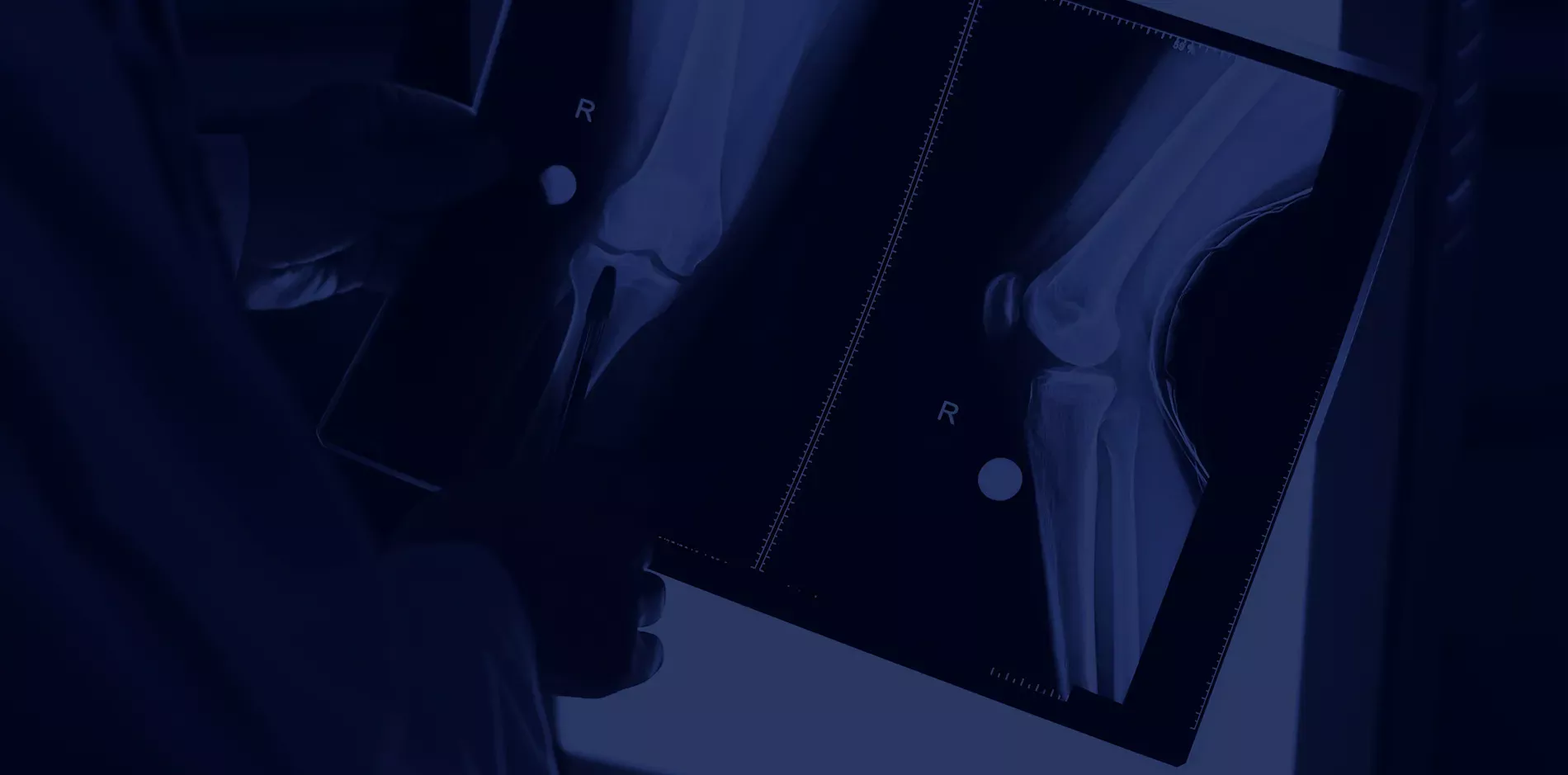 Arthroscanner