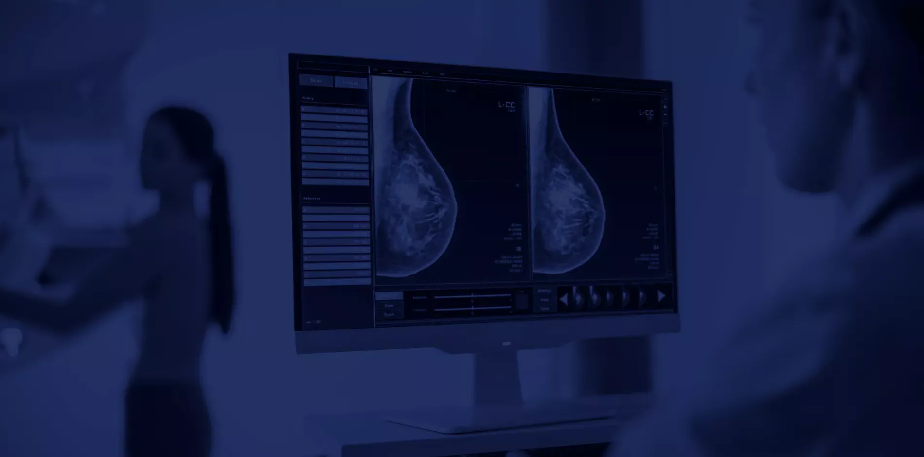 D&eacute;pistage organis&eacute; du cancer du sein