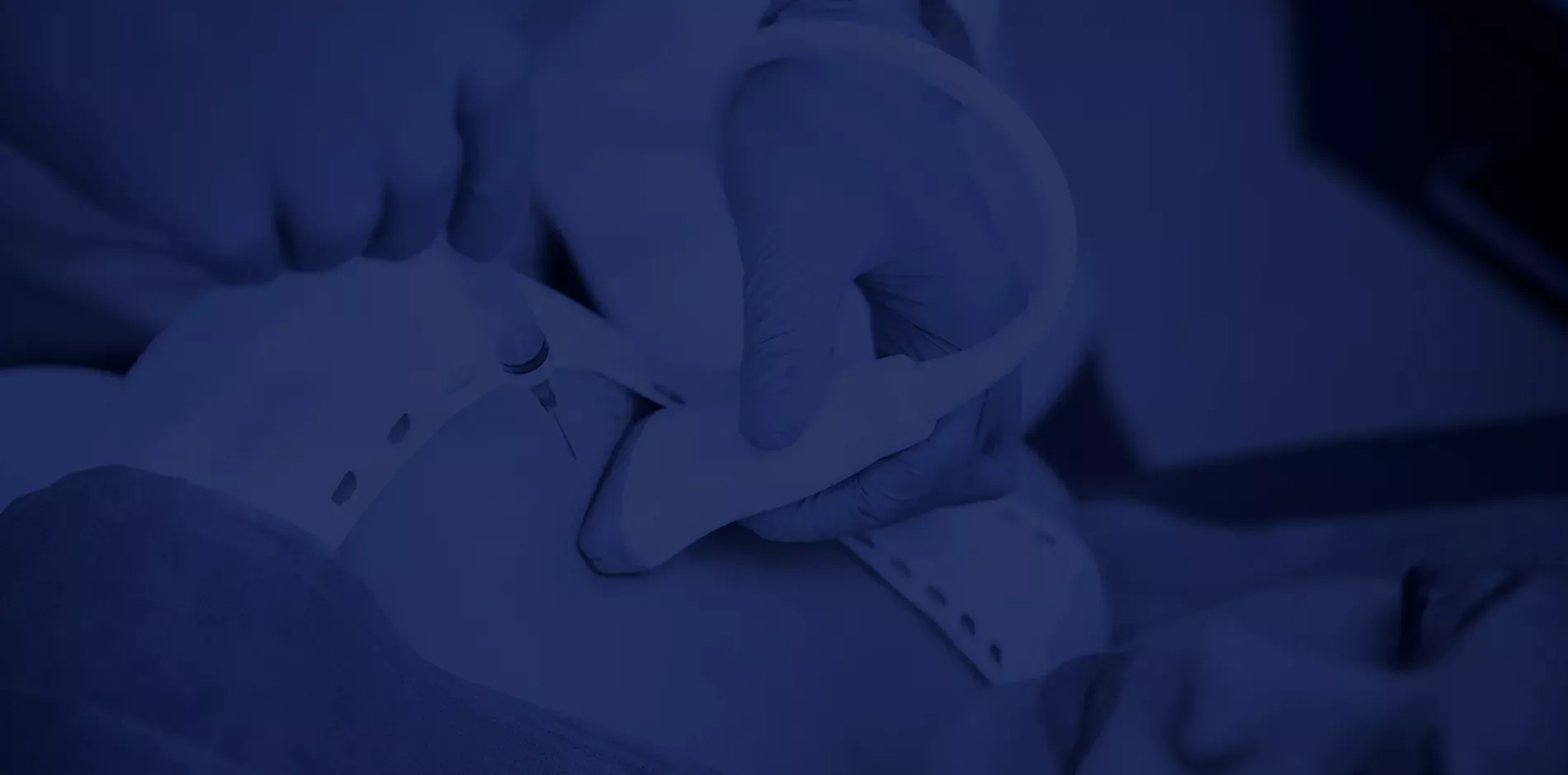 Ponctions et biopsies mammaires